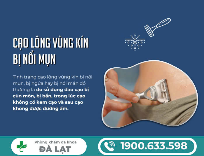 Hình ảnh minh họa